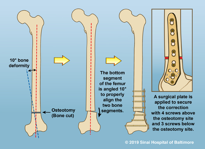 Correction Of Deformity – S.K.R Hospital And Trauma Center Pvt. Ltd ...